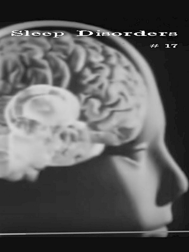 Sleep Disorders #17.